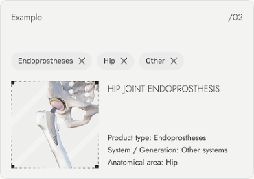 Filtering example — hip joint endoprosthesis